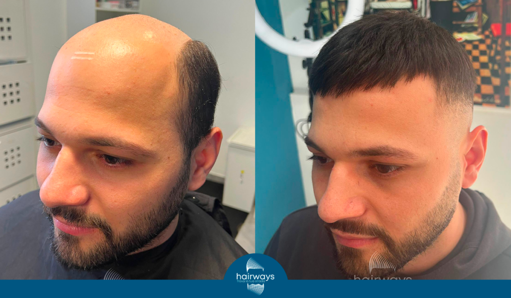 Che Cos è La Patch Cutanea